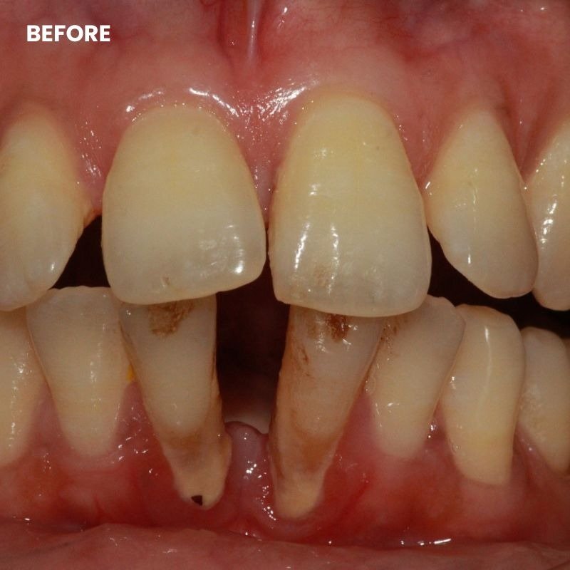 Before treatment